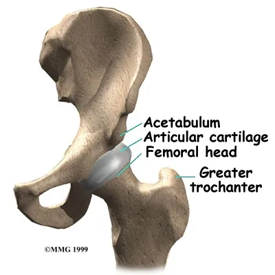 Avascular Necrosis of the Hip Anatomy