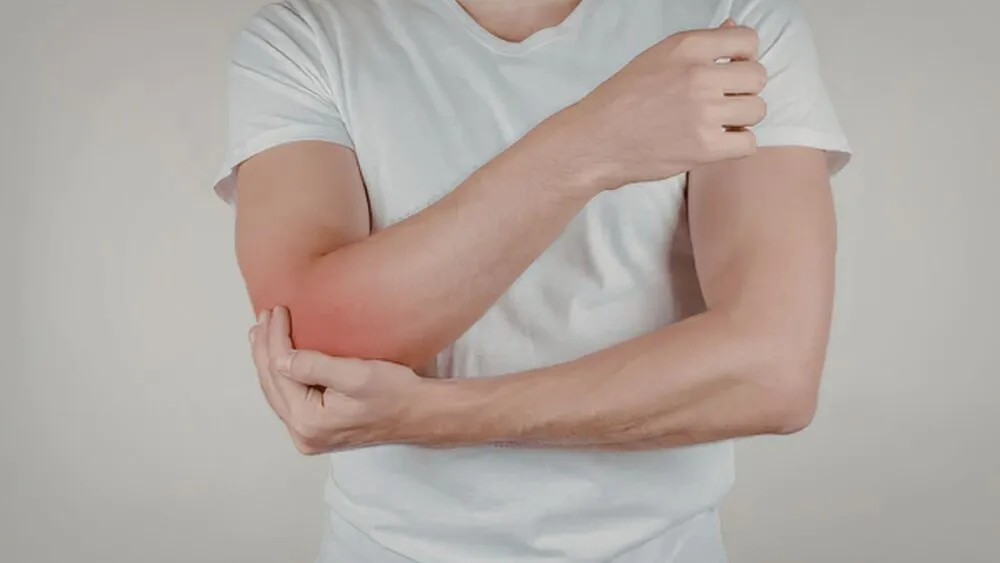 Cubital Tunnel Syndrome Cubital Tunnel Syndrome