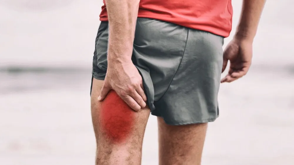Hamstring Injuries Hamstring Injuries