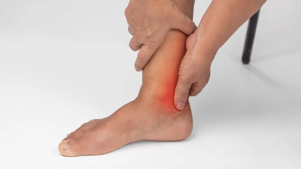 Peroneal Tendon 1 Peroneal Tendon 1