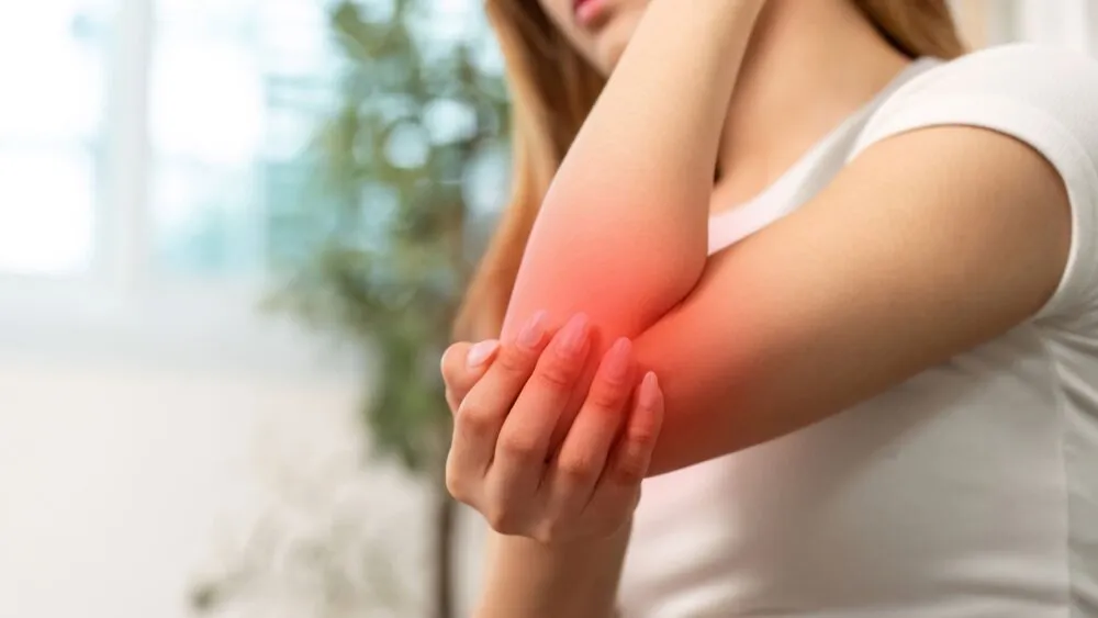 Radial Tunnel Syndrome Radial Tunnel Syndrome