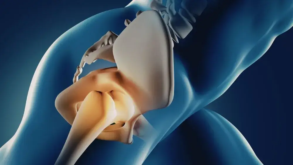 Sacroiliac Joint Dysfunction Sacroiliac Joint Dysfunction