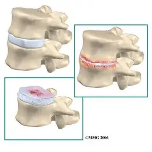 back pain 300x300 1 back pain 300x300 1