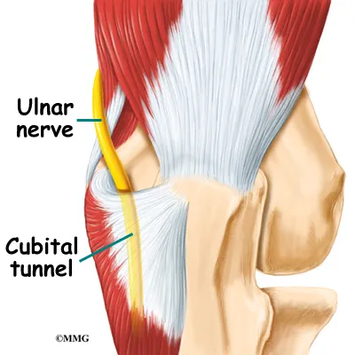 Elbow Cubital Tunnel Syndrome Anatomy