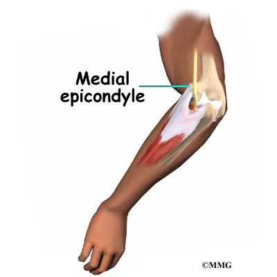 elbow cubtun cause01