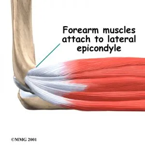 Tennis Elbow Anatomy