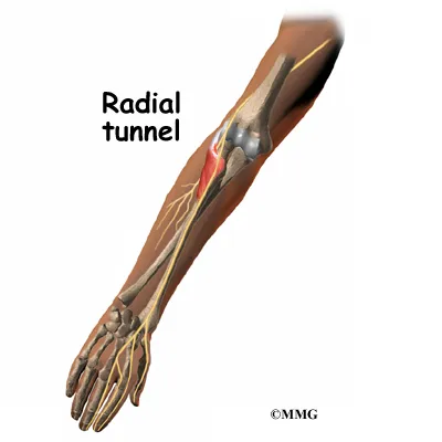 elbow radtun anatomy03