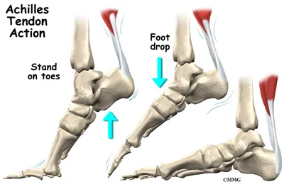 Foot Achilles Tendon Anatomy