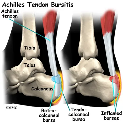 foot achilles tendon anatomy03