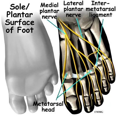 Foot Morton’s Neuroma Anatomy