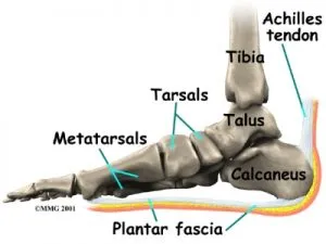 foot plantar fasciitis1 300x225 1