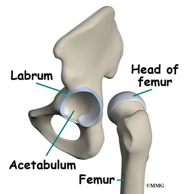 hip labral tear bones01