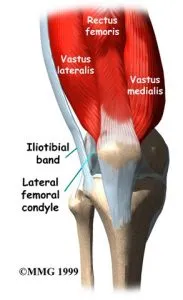 ITB Syndrome Anatomy