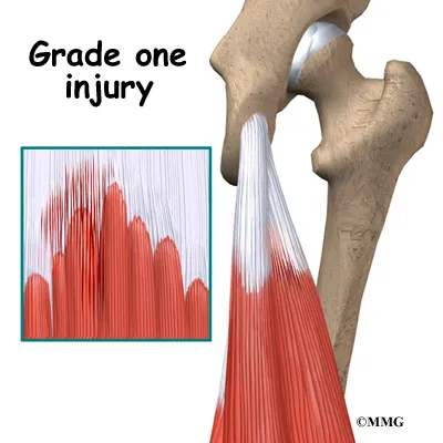 knee hamstring diagnosis01