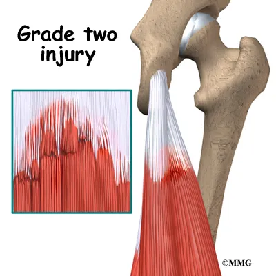 knee hamstring diagnosis02