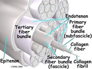 lat sprain 300x225 1