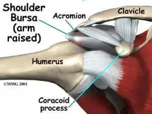 shoulder impingement details