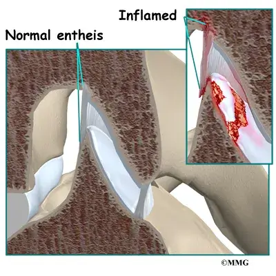 spondylo anatomy03 Causes