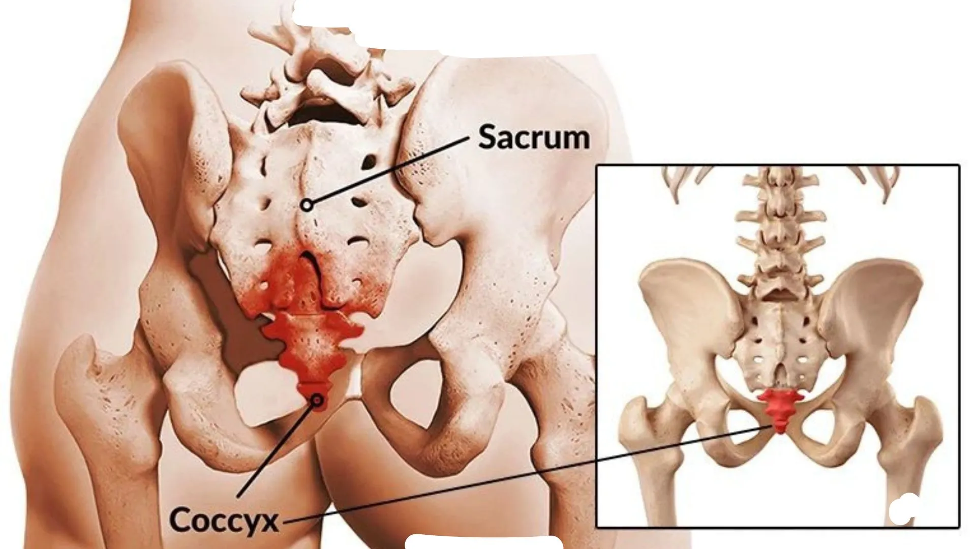 Clinical Associations: Pain and Dysfunction