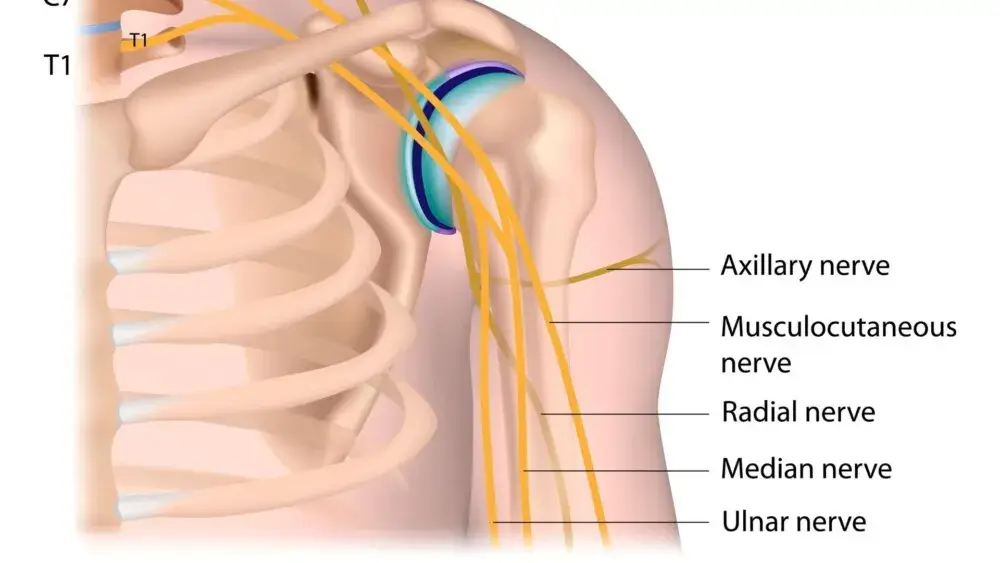 T1 To arms from the elbows down including hands arms wrists and fingers esophagus and trachea heart T1 To arms from the elbows down, including hands, arms, wrists and fingers; esophagus and trachea, heart