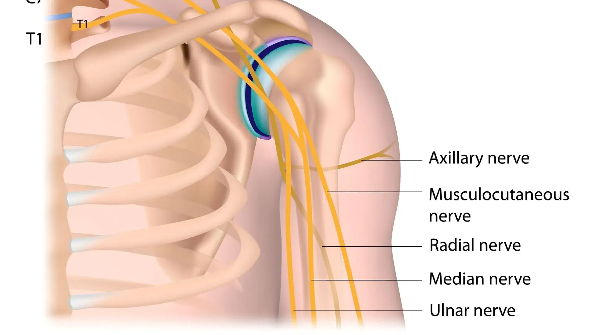 T1 To arms from the elbows down, including hands, arms, wrists and fingers; esophagus and trachea, heart