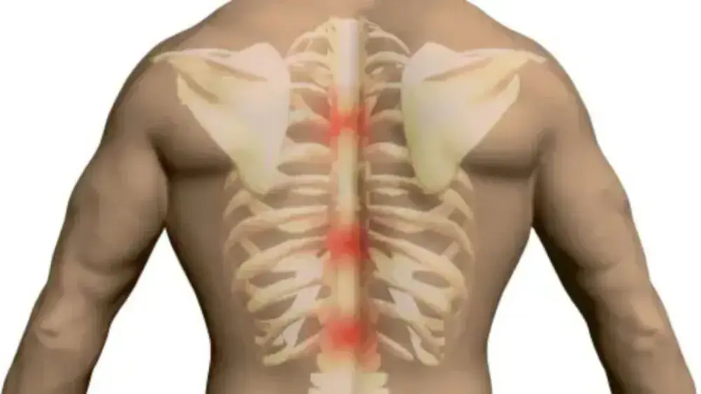 T2 To heart including its valves and covering coronary arteries lungs bronchial tubes T2 To heart including its valves and covering coronary arteries lungs bronchial tubes