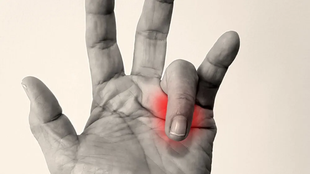 Trigger Finger and Trigger Thumb