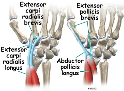 Wrist Intersection Syndrome Anatomy