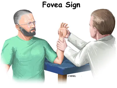 wrist tfcc diagnosis01